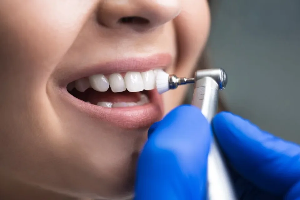 Professional teeth cleaning treatment at Align Dental